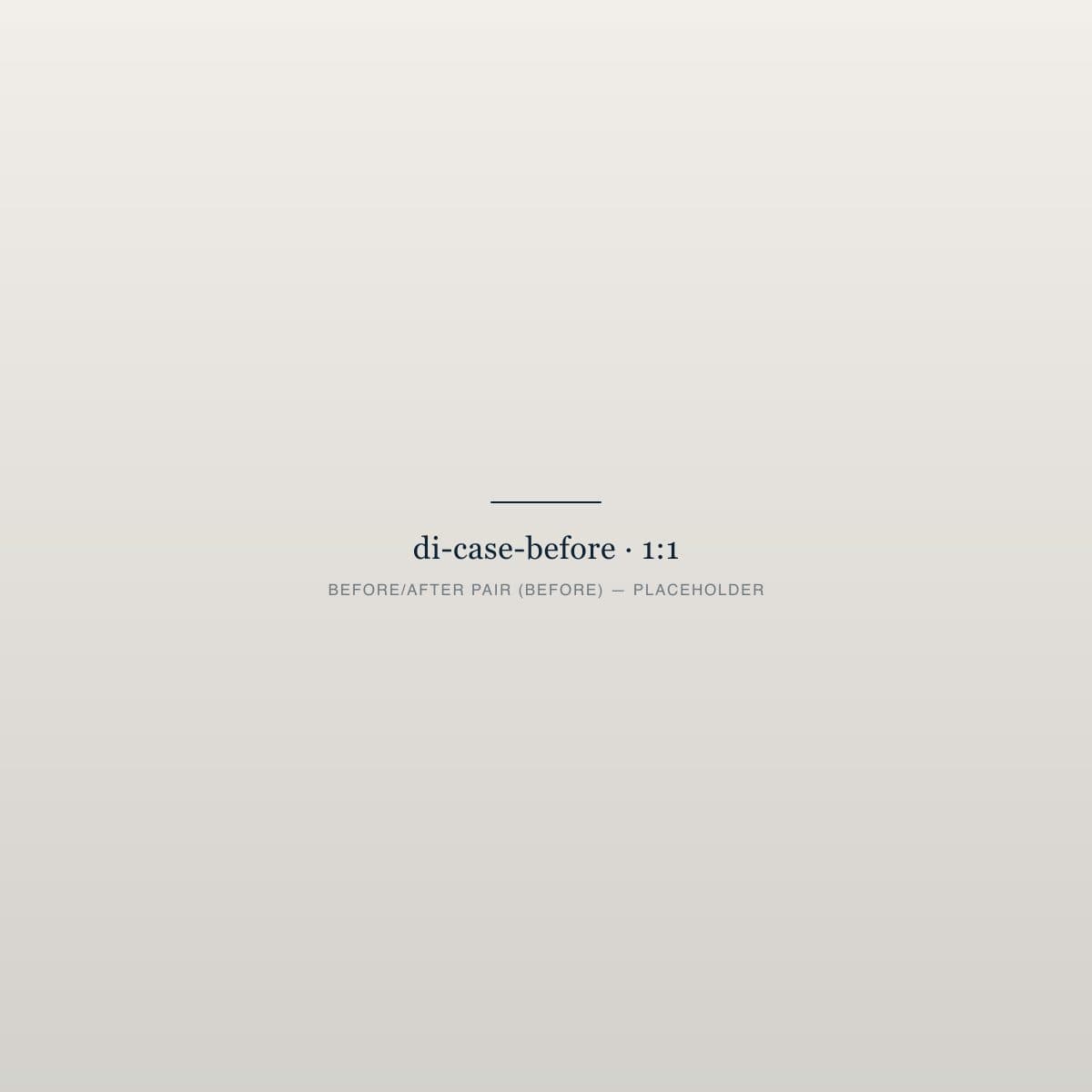 Paciente antes del implante dental de un solo diente, incisivo lateral superior izquierdo comprometido, caso de 5D Smiles